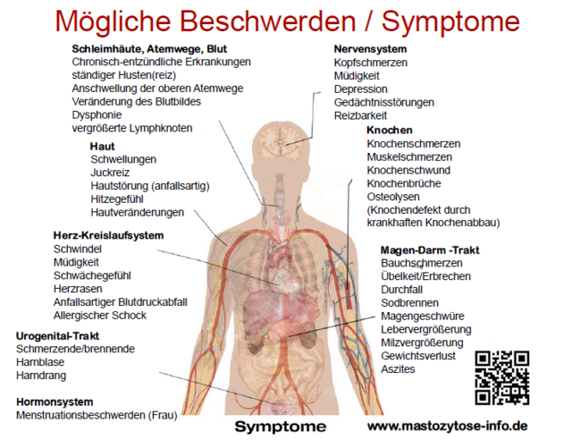 Grafik zu Beschwerden und Symptomen von Mastozytose.