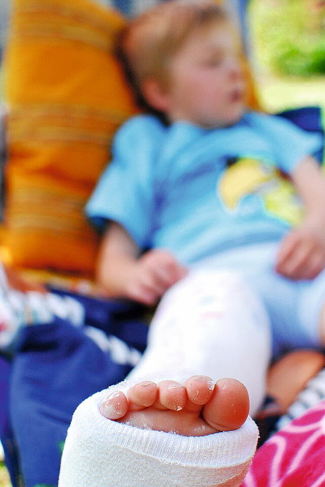 Fotografie eines Kindes mit einem eingegipsten Bein