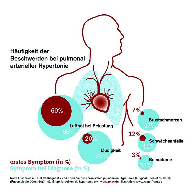 Ein Abbildung zeigt die Häufigkeit der Beschwerden bei pulmonal arterieller Hypertonie. 